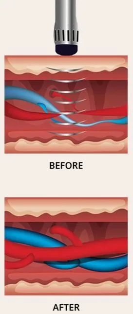gainswave therapy orlando