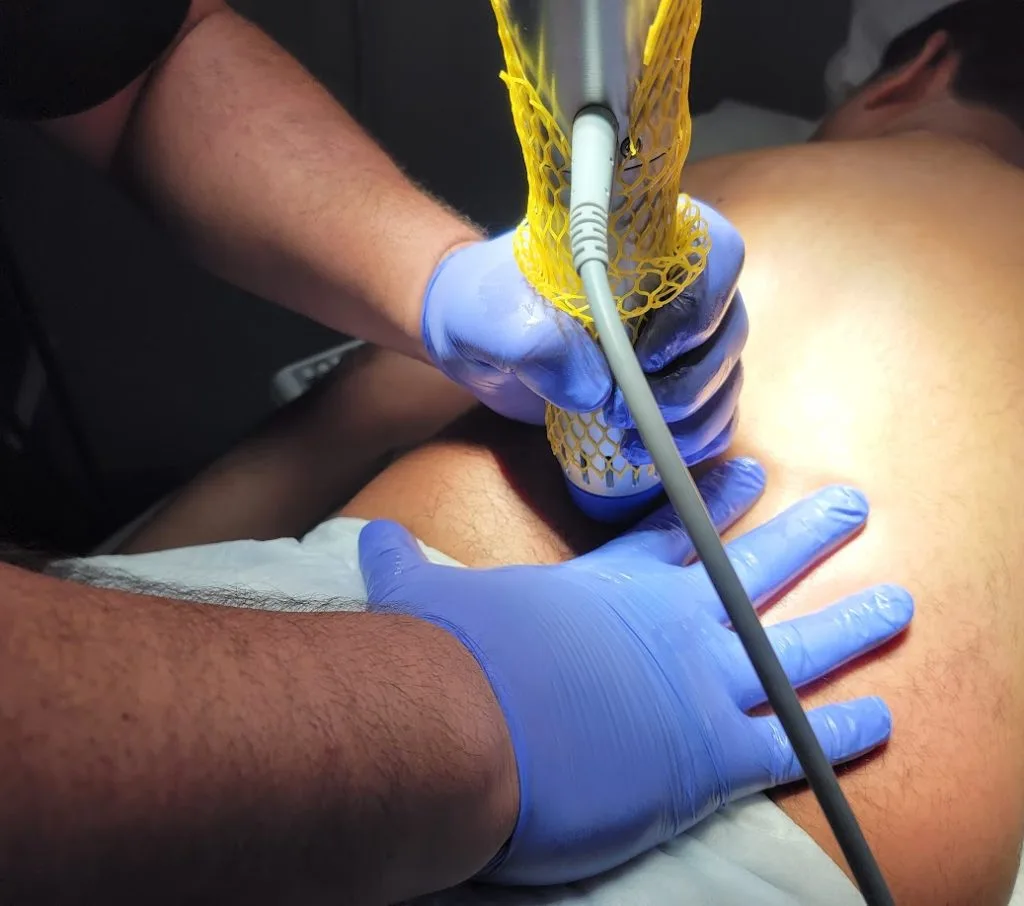 gainswave therapy orlando